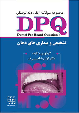 DPQ تشخیص و بیماری های دهان