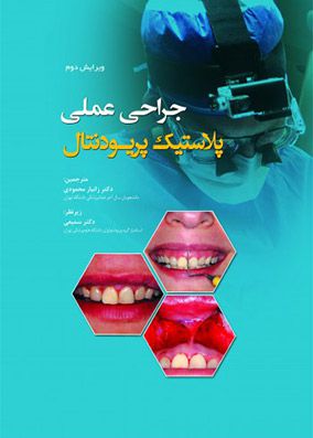 جراحی پلاستیک پریودنتال 2017 محمودی
