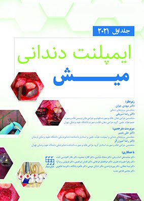 ایمپلنت دندانی میش ۲۰۲۱ جلد 1 | رضا شریفی - مهدی جوان | انتشارات شایان نمودار