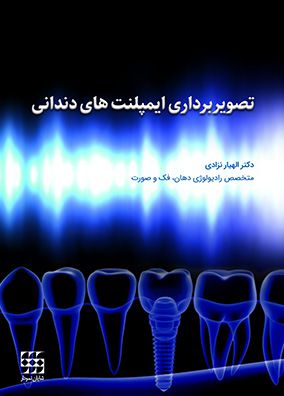 تصویربرداری ایمپلنت های دندانی | دکتر الهیار نزادی | انتشارات شایان نمودار