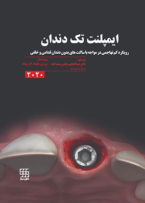 ایمپلنت تک دندان | عبدالعظیم حاتمی | انتشارات شایان نمودار