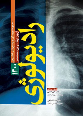 سوالات آزمون بورد و ارتقا تخصصی رادیولوژی همراه با پاسخ تشریحی | علی طالبی | انتشارات آرتین طب
