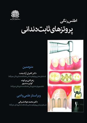 اطلس رنگی پروتز های ثابت دندانی | کامران آزاد بخت | انتشارات آرتین طب