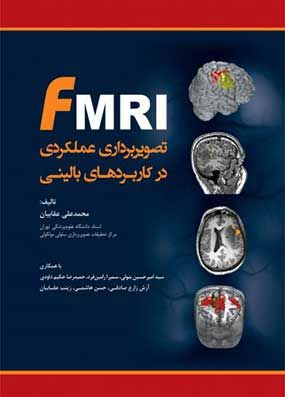 خرید کتاب FMRI عقابیان تصویربرداری عملکردی در کاربردهای بالینی با تخفیف