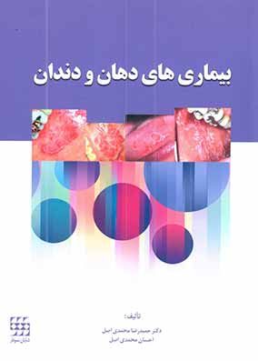 کتاب بیماری های دهان و دندان محمدی
