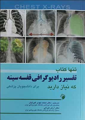 تنها کتاب تفسیر رادیوگرافی قفسه سینه که نیاز دارید(ترجمه کتاب Chest x-ray) 