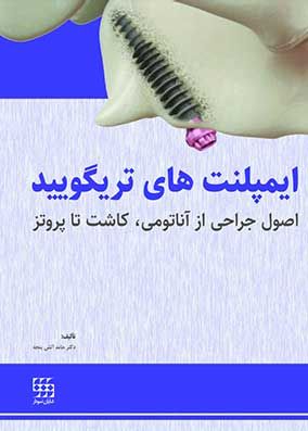 کتاب ایمپلنت های تریگویید "اصول جراحی از آناتومی، کاشت تا پروتز"