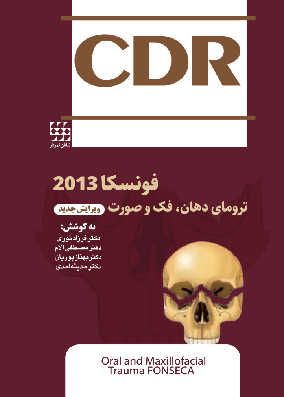 CDR فونسکا 2013