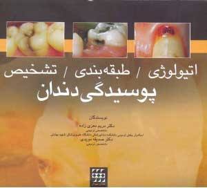 خرید کتاب اتیولوژی طبقه بندی تشخیص پوسیدگی دندان معزی زاده انتشارات شایان نمودار