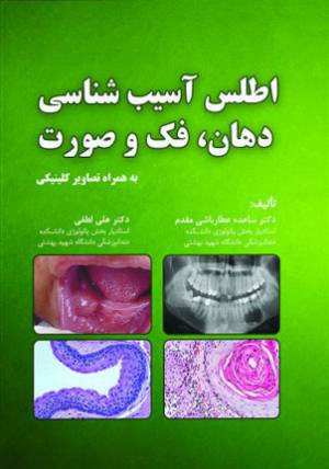 خرید کتاب اطلس آسیب شناسی دهان عطارباشی مقدم انتشارات رویان پژوه