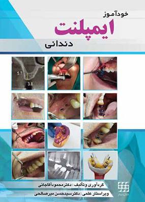 خرید کتاب خودآموز ایمپلنت دندانی آقاجانی انتشارات شایان نمودار